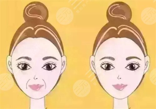 拉皮除皱降低风险吗 拉皮除皱降低风险吗