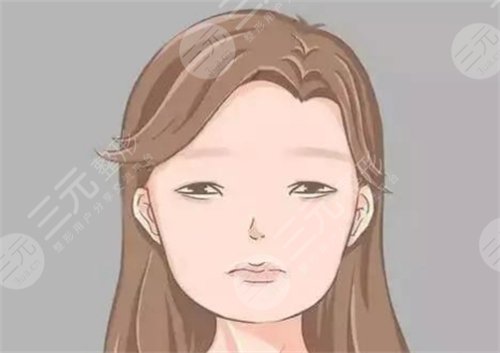 去颊脂垫术前该做些什么呢