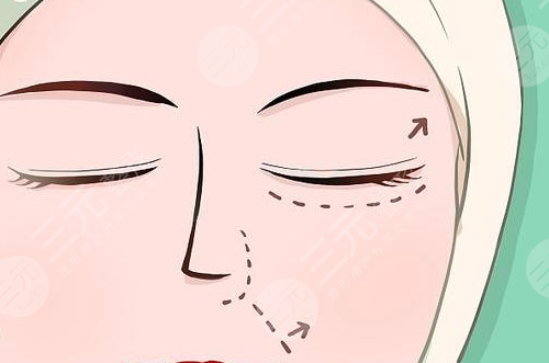眼部整形后如何避免后遗症