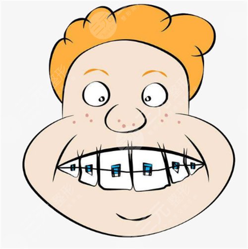 成人龅牙矫正怎么样,应用什么方法比较好?