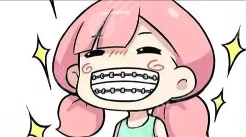 牙科私人贵还是医院贵带牙套