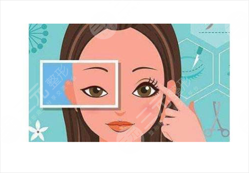 上睑下垂矫正果对比图