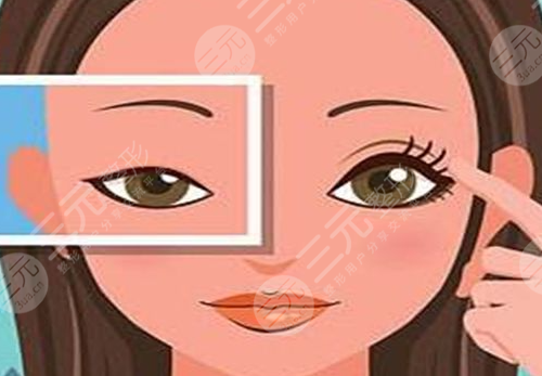 上眼睑轻度下垂怎么办