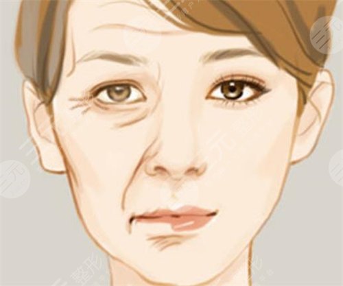 注射瘦脸/除皱去皱的副作用有吗？有哪些注意事项？