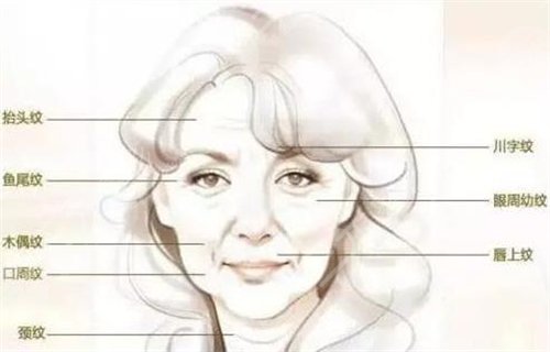玻尿酸去皱大概要多少钱?玻尿酸除皱维持多久 玻尿酸去皱大概要多少钱?玻尿酸除皱维持多久