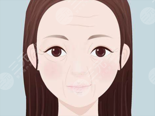 基本去除抬头纹去除抬头纹的价钱多少