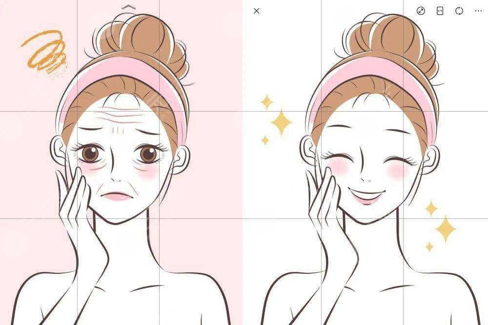 水波拉皮是怎么做的能维持多久水波拉皮除皱价格是多少