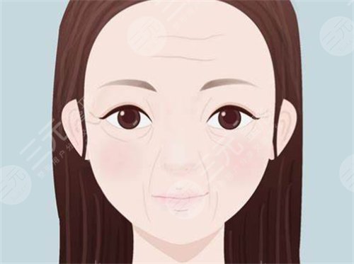 手术除皱过程是怎样的?恢复期要多久? 手术除皱过程是怎样的?恢复期要多久?