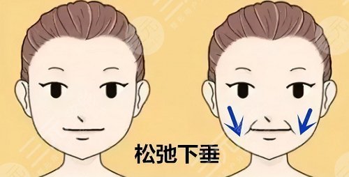 xqp填充好不好、一般可以维持多久