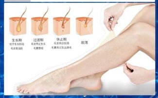 大腿激光脱毛价格贵不贵?大腿激光脱毛多少钱?