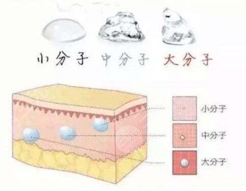宁波去鼻唇沟多少钱呢？