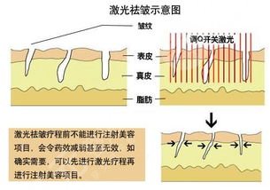 颈纹怎么消除，去颈纹果怎么样