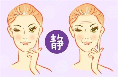 生物注射去皱有副作用吗？