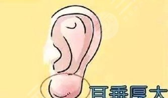 成都耳垂整形术多少钱