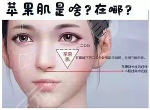 玻尿酸丰苹果肌能保持多久?