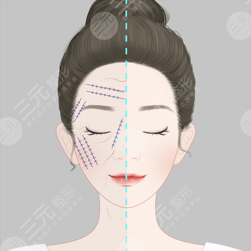 全身美白需要多少钱 韩国明星教你如何全身美白