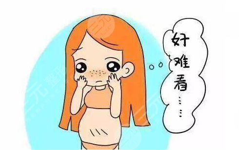 产后如何去掉腹部肚皮妊娠纹 去除产后腹部肚皮妊娠纹的喜欢办法