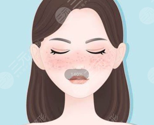 光子嫩肤的优势有哪些？果怎么样？