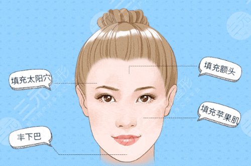 玻尿酸面部填充的原理 能保持多久 需要注意什么