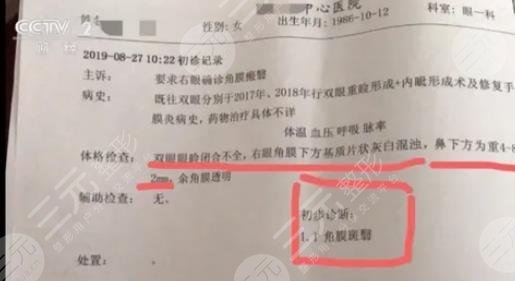 女子整容整出九级伤残是真的吗?