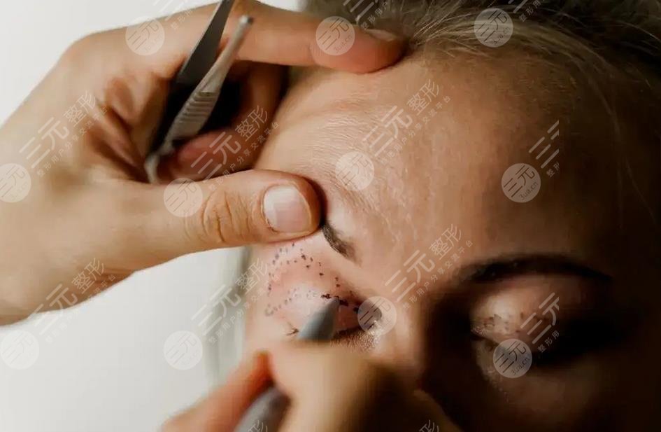 女子整容整出九级伤残是真的吗?