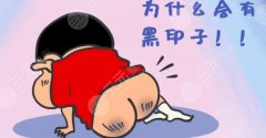 臀部坐印激光后注意事项分享！这7件事牢记心间，蜜桃美臀更撩人~