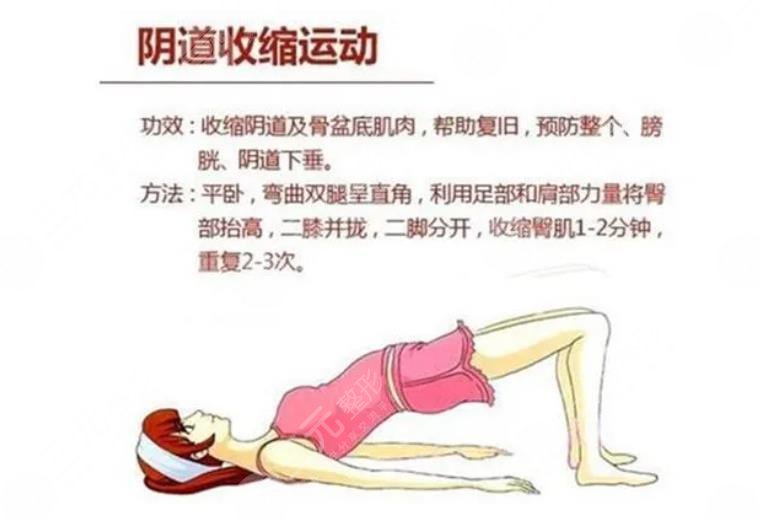 产后缩阴方法小妙招分享