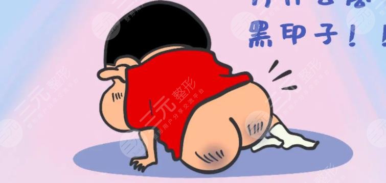 臀印