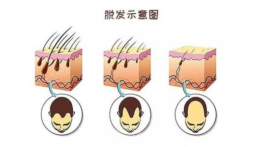 促进毛囊生发的食物盘点