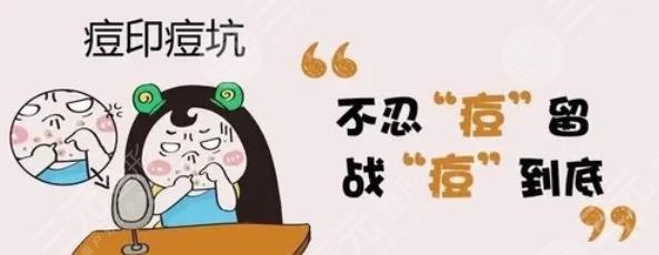 激光祛痘