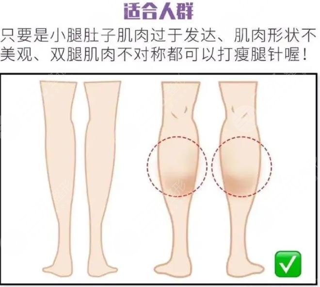 怎么瘦小腿有方法