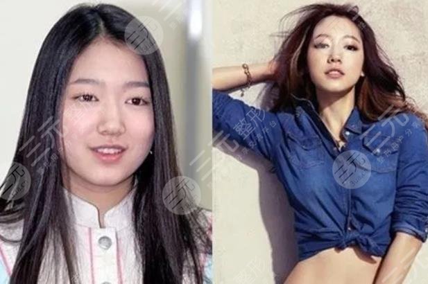 朴信惠整容前后照片