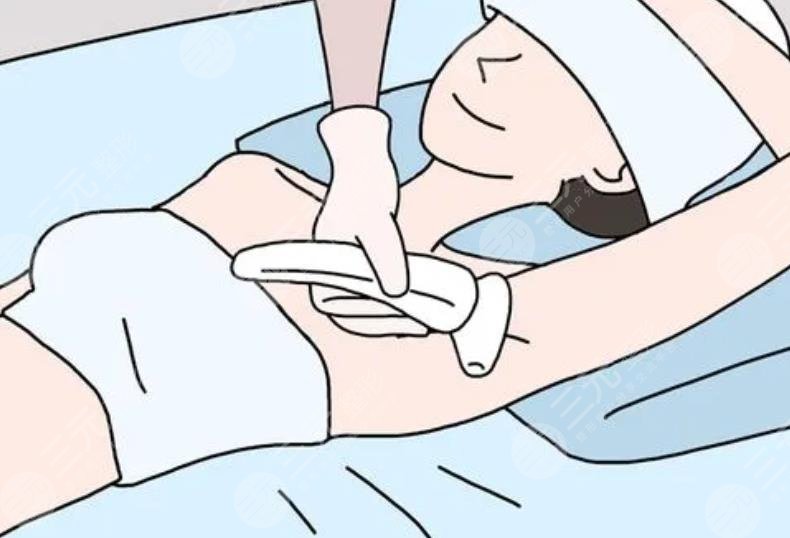 冰点脱毛的术前注意事项