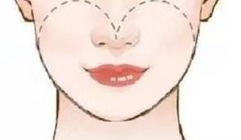 磨骨