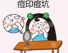 男生脸上痘印痘坑怎么去掉？迅速get这3种方式，附术后护理大全