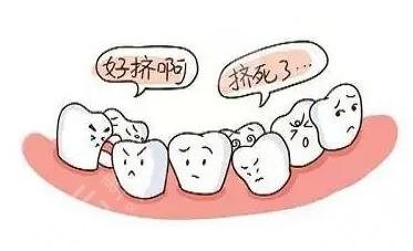 牙齿矫正前