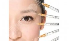 注射胶原蛋白哪个牌子好？主要功是什么？维持多久？女性皮肤保养秘笈~