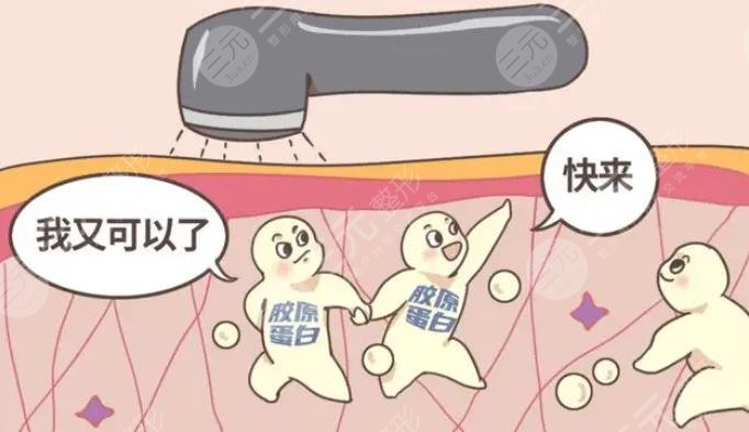 胶原蛋白注射之后需要注意什么?