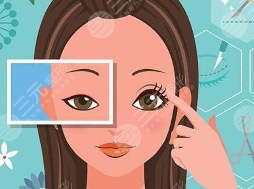 女子割双眼皮!当场丧命