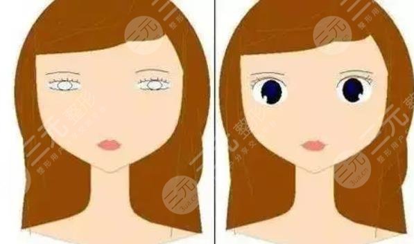 女子割双眼皮!当场丧命