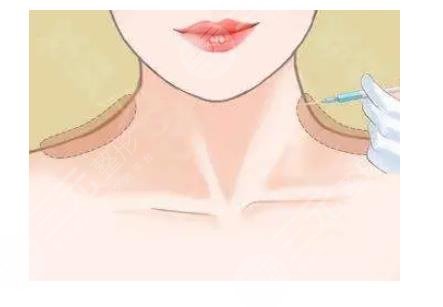 打三次能保持多久果?可以做按摩吗?