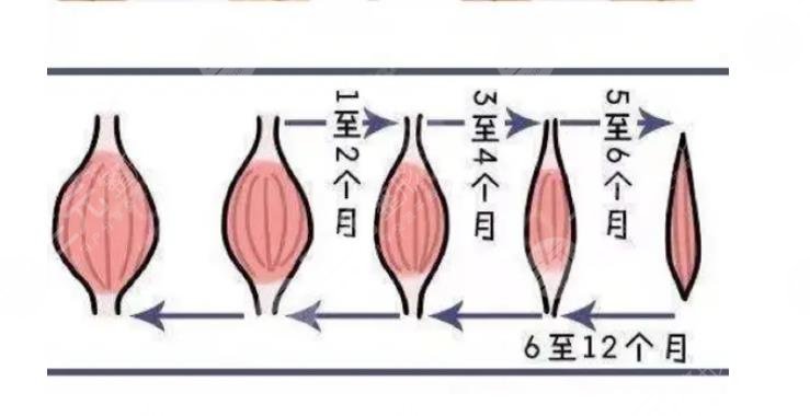 打三次能保持多久果?可以做按摩吗?