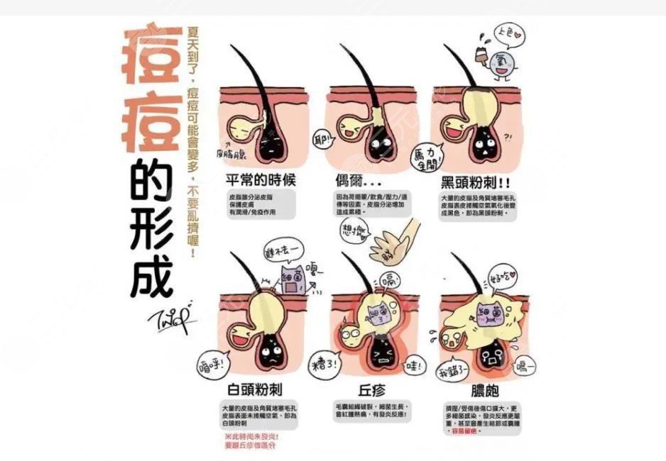 后背长痘痘是什么原因?