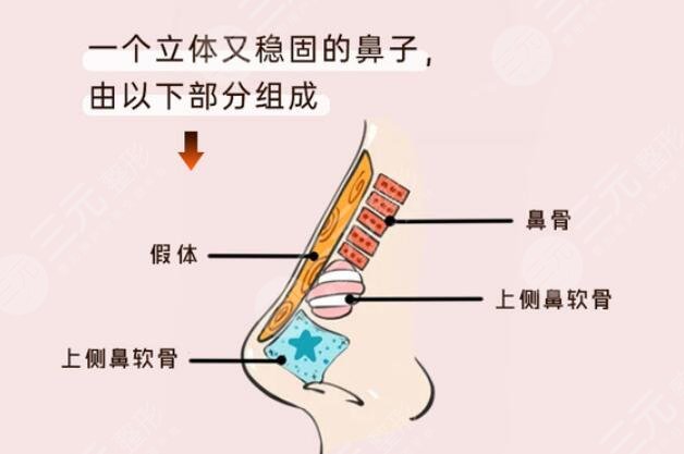 珊瑚骨隆鼻的术前注意