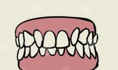 轻度地包天和重度地包天区别有哪些？一步教你辨别，附带解决方法