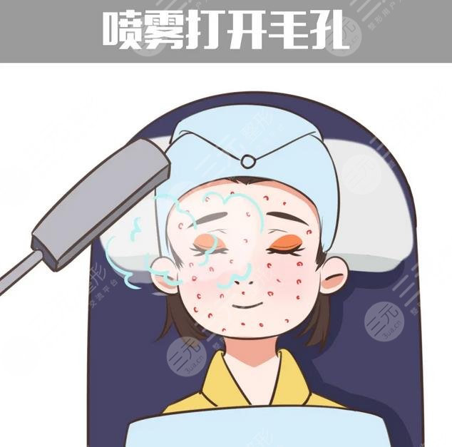 专业祛痘方法有哪些