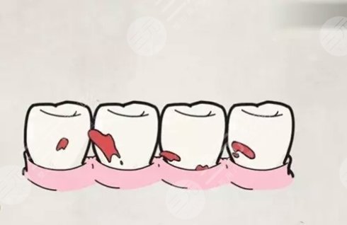 牙齿松动疼痛是什么原因?
