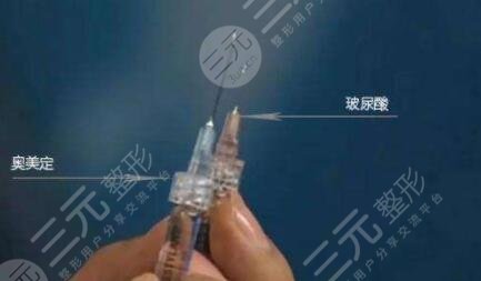 取奥美定多久能恢复？要休息多久时间？早发现早缓解才是正确的选择！