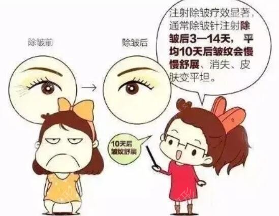 注射除皱注射前后果对比
