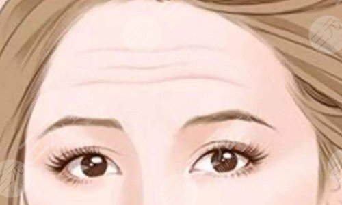 额头填充脂肪能维持多久时间？注意事项、护理等超全盘点！